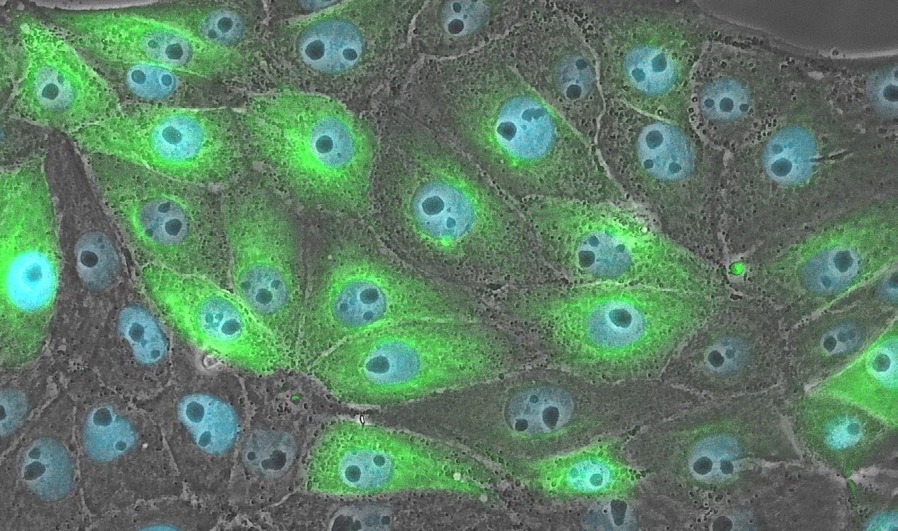 Axiovert 5 多功能应用研究级倒置显微镜